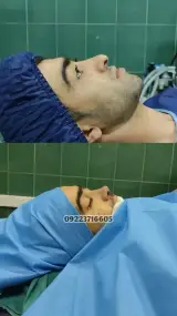 عمل بینی ملل کلینیک