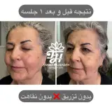 مرکز پوست‌ و ماساژ فریما حاجی زاده