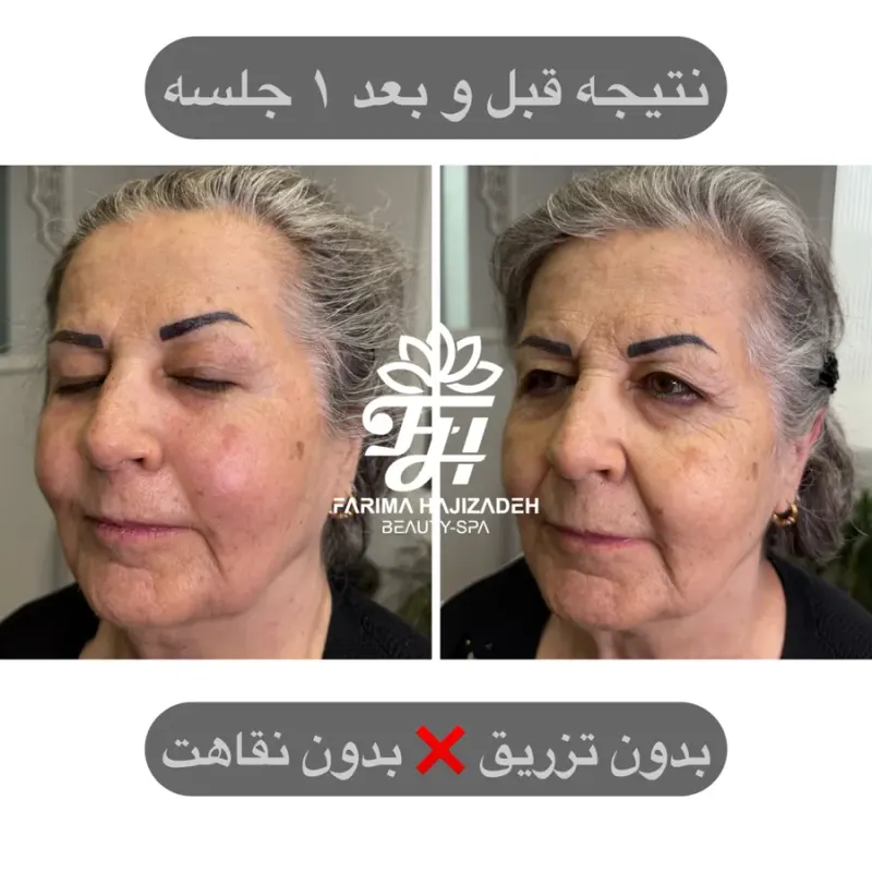 مرکز پوست‌ و ماساژ فریما حاجی زاده
