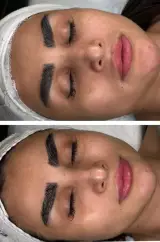 خدمات فیشال ،پاکسازی ندادمیرچی کلینیکBKD