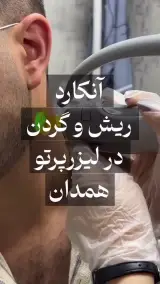 مرکز لیزر پرتو همدان