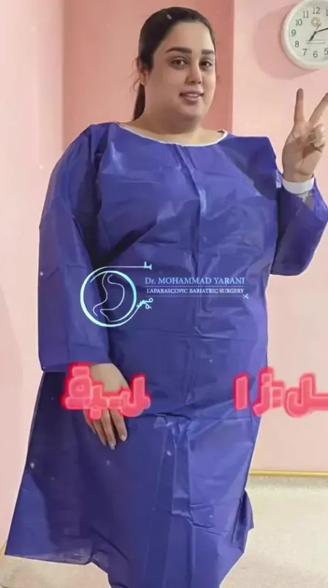 فلوشیپ فوق تخصصی جراحی (اسلیو بایپس)