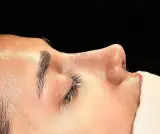 جراح زیبایی بینی توسط فوق تخصص