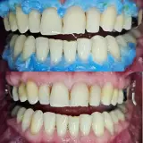 دندانپزشکی موسوی حتی تعطیلات بیمه نداریم