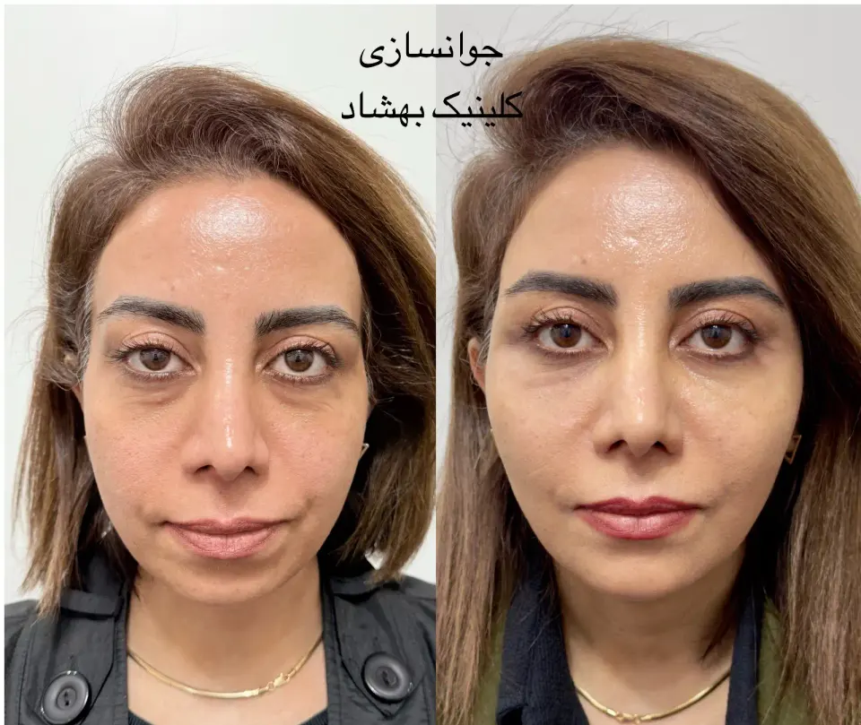 کلینیک تخصصی پوست و‌زیبایی بهشاد