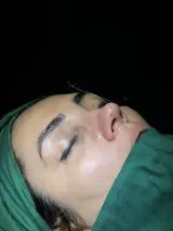 جراحی زیبایی بینی (دکتر مهدی محمدی)