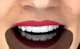 خدمات دندانپزشکی دکتر زهرا خلیلی