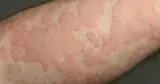 کلینیک فوق تخصصی آسم و آلرژی ونک