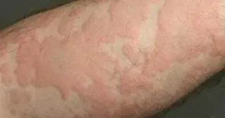 کلینیک فوق تخصصی آسم و آلرژی ونک