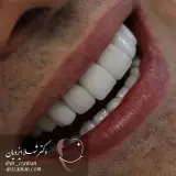 دندانپزشکی زیبایی اسمایل اسپا