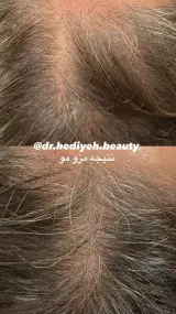 کلینیک زیبایی دکتر هدیه دهقانپور