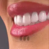 دندانپزشکی دیجیتال مارکیز VIP