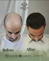 کلینیک زیبایی بلژو