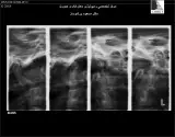 رادیولوژی فک و صورت دکتر مسعود ورشوساز