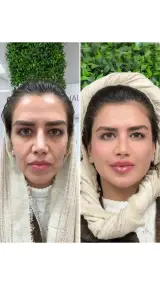 خدمات زیبایی دکتر جلودار