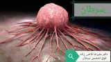 دکتر علیرضا قاضی زاده