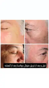 خدمات تخصصی فیشیال لیاناز اسکین هوم