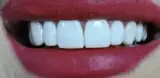 کلینیک دندانپزشکی لبخندساز (بیمه نداریم)