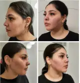 مرکز لاغری، زیبایی حس خوب بانوان
