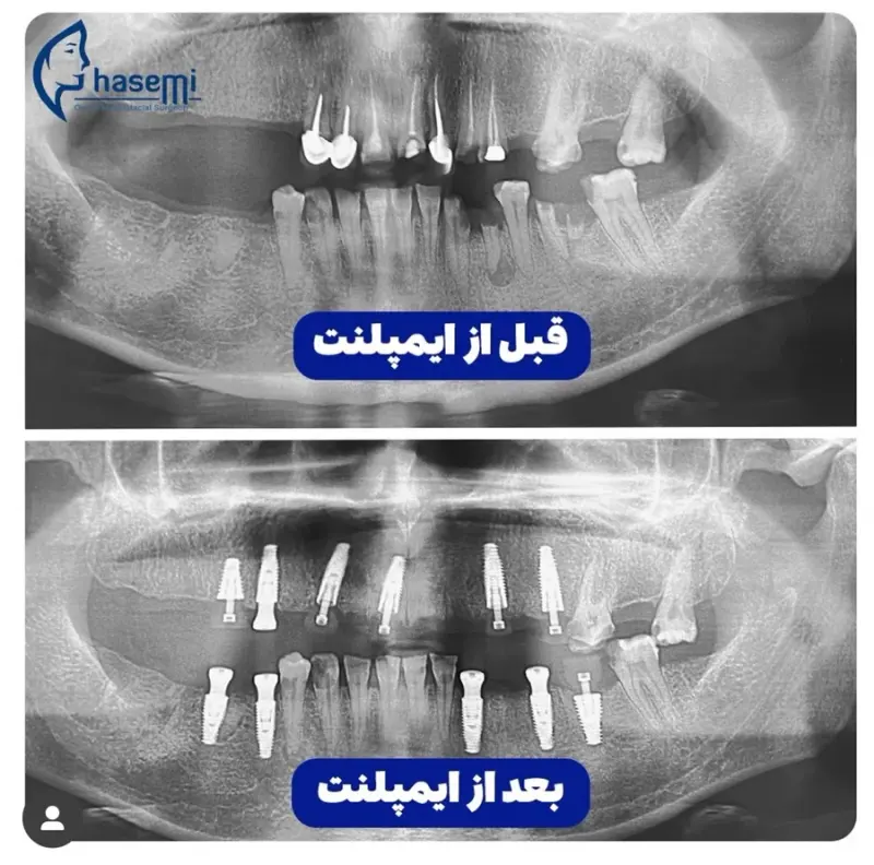 کلینیک جراحی فک و صورت دکتر قاسمی