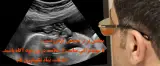 سونوگرافی، رادیولوژی دیجیتال بازتاب