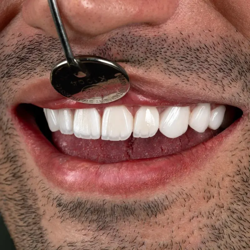 کلینیک دندانپزشکی سحر(هیچ بیمه ای نداریم
