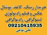 خریدار زینک و فیلم باطله