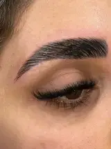 خدمات تخصصی لیفت ابرو مریم