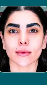 دکتر زیبایی علیرضا قاسمی