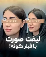 کلینیک زیبایی مانشید