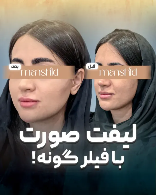 کلینیک زیبایی مانشید