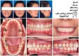 فتوگرافی پزشکی پیکس طب