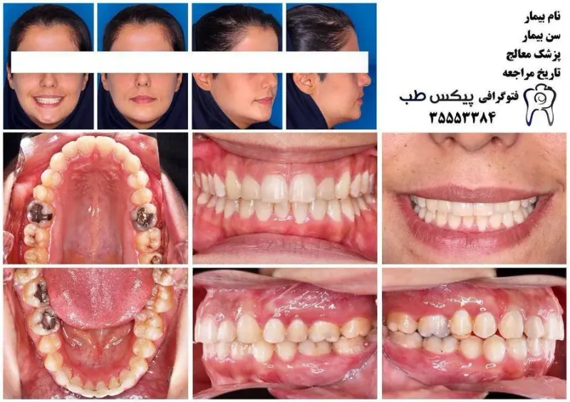 فتوگرافی پزشکی پیکس طب