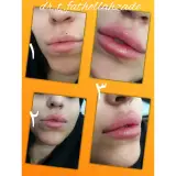 مطب پوست و مو و لیزر ارکیده