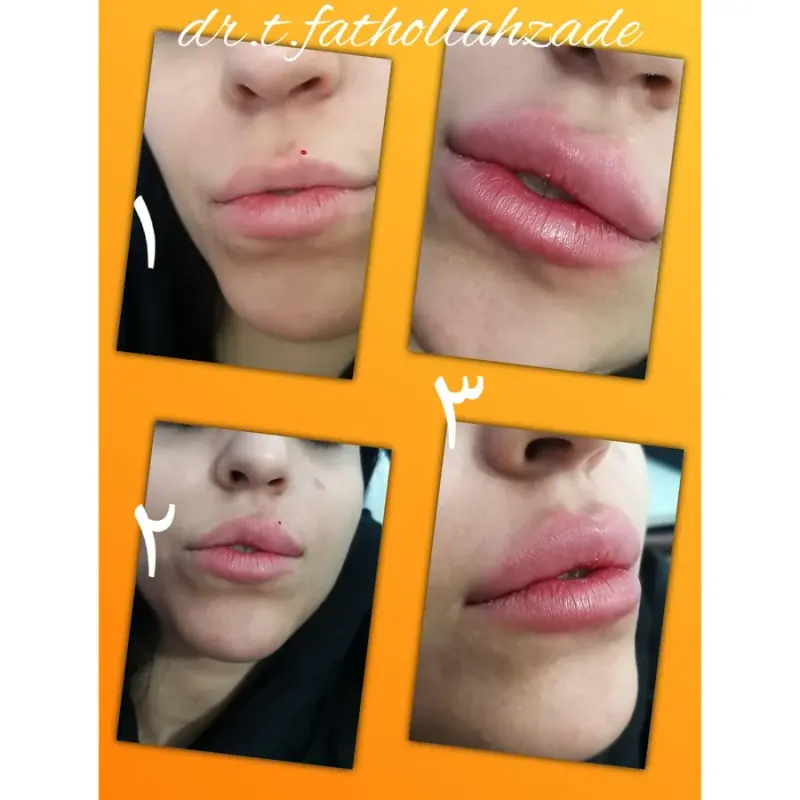 مطب پوست و مو و لیزر ارکیده