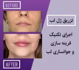 مرکز پوست و مو لیزر نیل در شاهین شهر