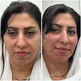 مطب لیزر و زیبایی گلها(سانا اسکین سابق)