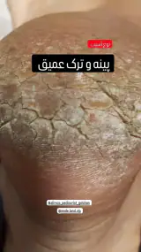 اولین مرکز تخصصی و درمانی اسپا آقایان