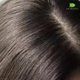 لوسیون ضد شپش آیوروکا ایورمکتین صددرصد ت