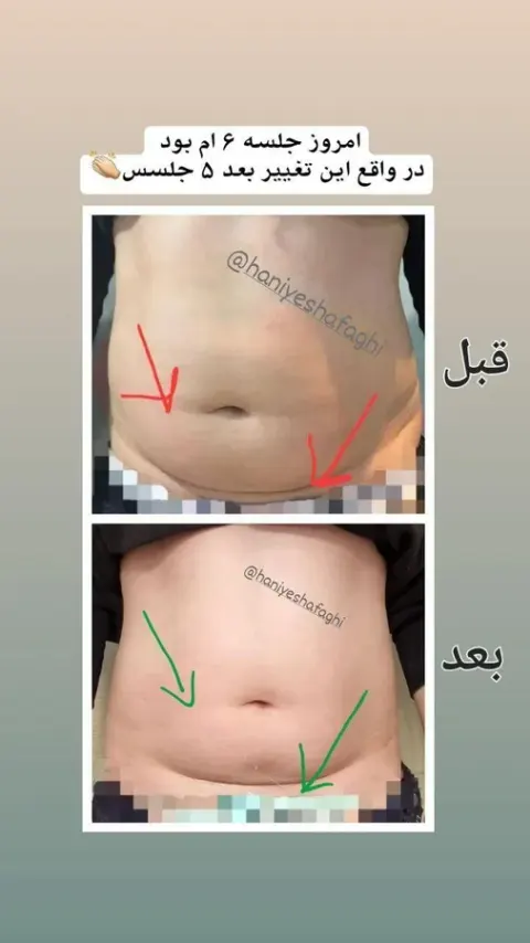 کلینیک تغذیه و رژیم درمانی امگا