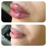 کینیک زیبایی روشا