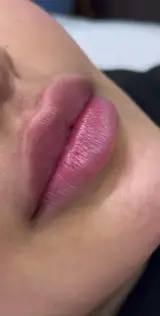 مرکز پوست، مو، زیبایی و لیزر هُلو