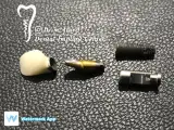 مرکز ایمپلنت دکتر علوی