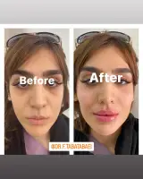 دکتر زیبایی فاطمه طباطبایی
