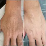فیشال و پاکسازی تخصصی پوست سودی ثبتی