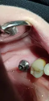 مطب دندانپزشکی دکتر روح اله میراحمدی