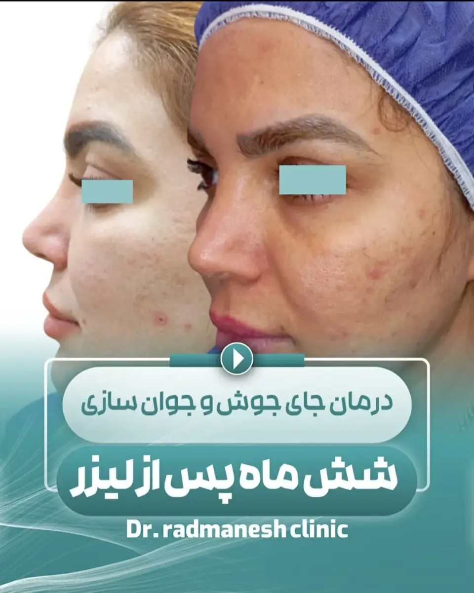 کلینیک زیبایی و لیزر دکتر رادمنش
