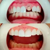 دندانپزشکی دکتر رضا برازنده