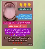 درمان با طب سنتی مشاوره رایگان
