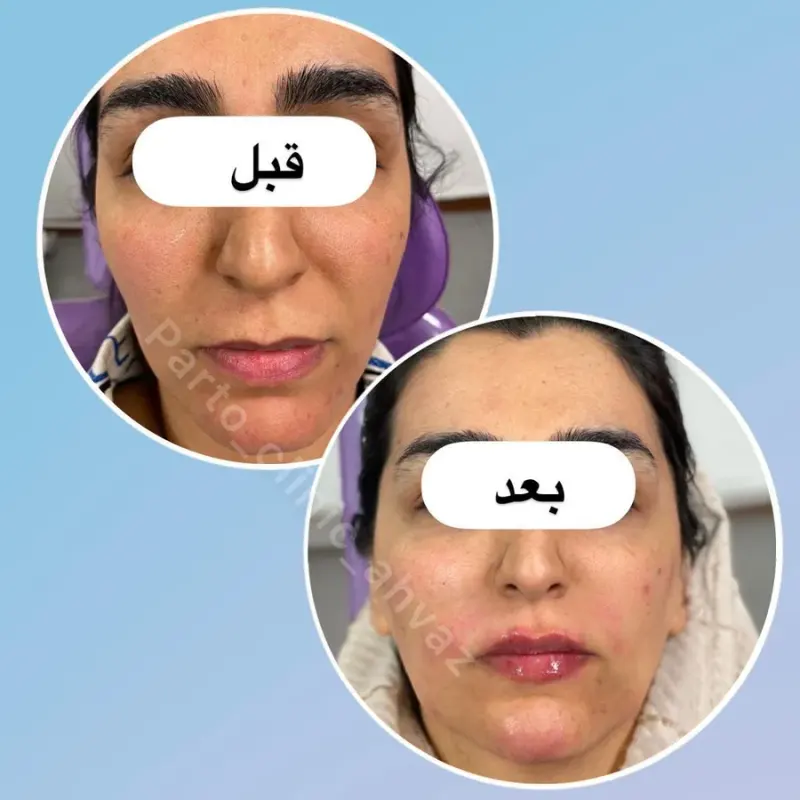کلینیک زیبایی پرتو